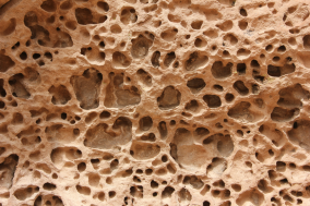 Bone health & Osteoporosis